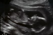 The website includes ultrasound images of the Arnolds' unborn baby, ...