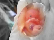 human-fetus