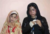acid-attack-afghanistan