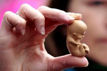 12-week-old-embryo