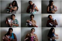 babies-with-microcephaly-in-brazil-due-to-zika