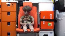 wounded-syrian-boy-in-aleppo